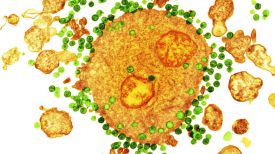 Клетки вируса ВИЧ. Фото Science Source