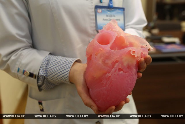 В Беларуси успешно провели первые операции с использованием 3D-модели сердца