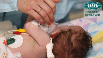 Белорусские врачи спасли 2-месячного ребенка с тяжелейшей пневмонией, вызванной коронавирусом